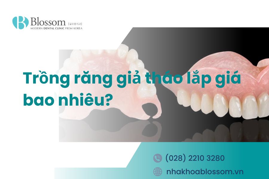 Trồng răng giả tháo lắp giá bao nhiêu? – Nha Khoa Blossom
