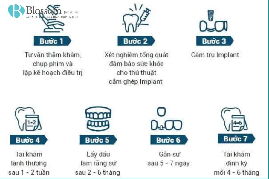 Trồng răng implant có đau không? Yếu tố ảnh hưởng trồng Implant? 9 trong rang implant co dau khong 8