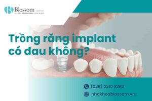 Trồng răng implant có đau không? Yếu tố ảnh hưởng trồng Implant?