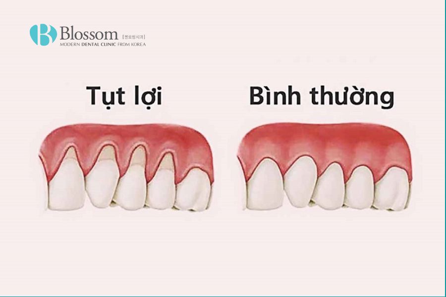 tut nuou 1