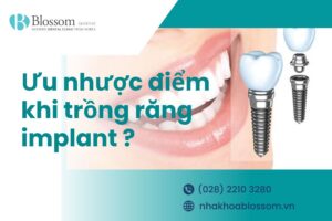 Ưu nhược điểm khi trồng răng implant như thế nào?
