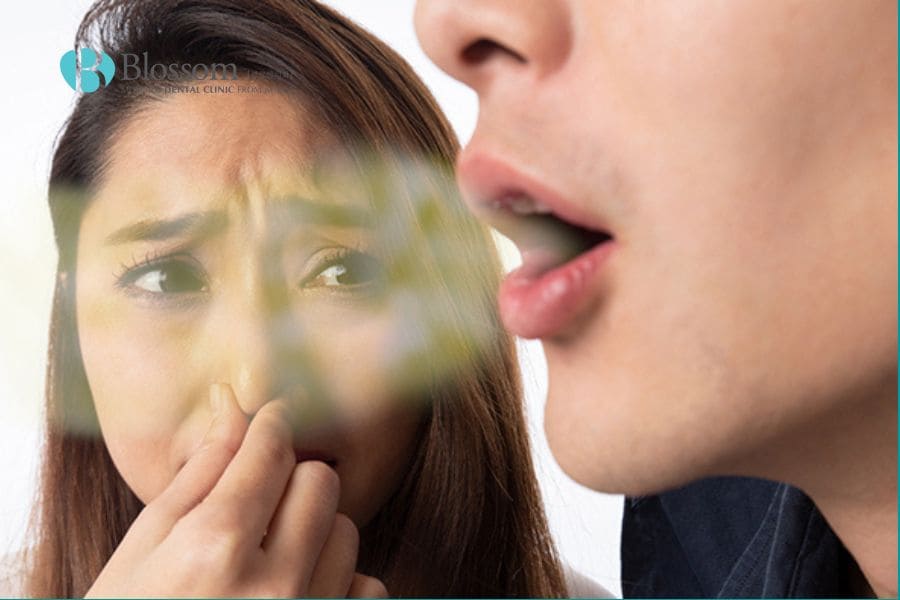 Vì sao bị đau nướu răng? Nguyên nhân gây đau nướu răng. 6 vi sao bi dau nuou rang 5