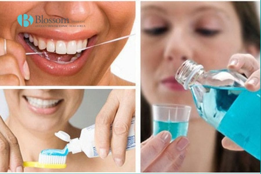 Viêm nướu bao lâu thì khỏi. Cách điều trị và phòng tránh viêm nướu. 9 viem nuou bao lau thi khoi 9