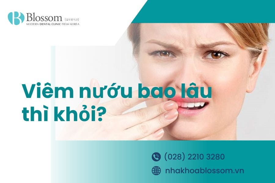 Viêm nướu bao lâu thì khỏi. Cách điều trị và phòng tránh viêm nướu.