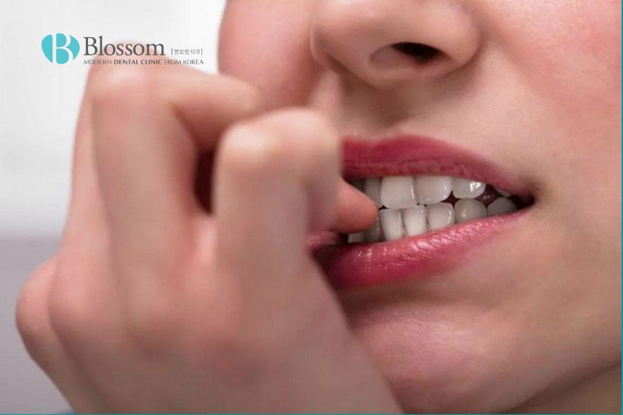 Viêm nướu răng nên ăn gì cho mau khỏi? 13 viem nuou rang nen an gi 12