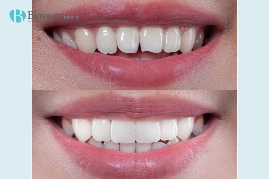 Tìm nha khoa quận 3 chất lượng? TOP 3 địa chỉ nha khoa bạn không nên bỏ qua 9 nha khoa quan 3 10