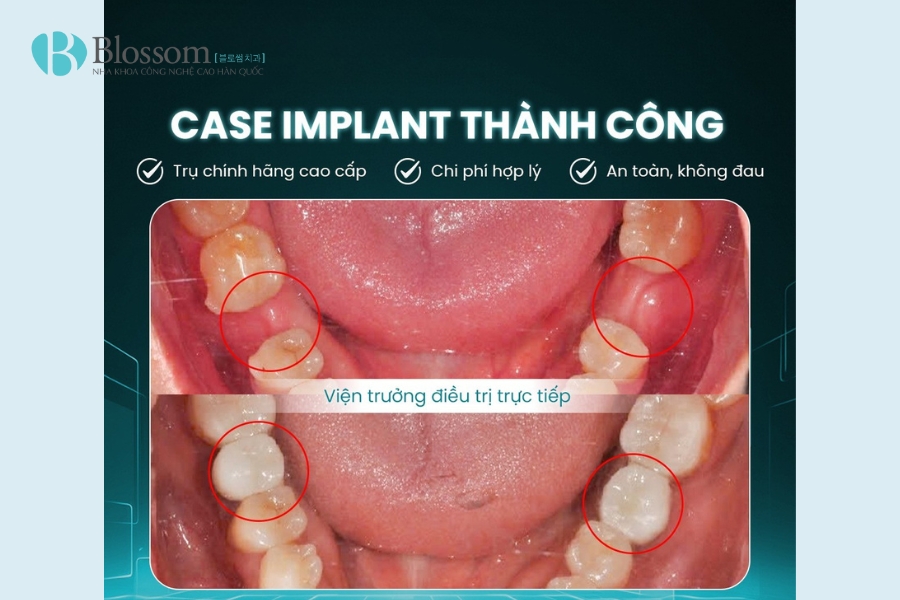 Tìm nha khoa quận 3 chất lượng? TOP 3 địa chỉ nha khoa bạn không nên bỏ qua 11 nha khoa quan 3 12