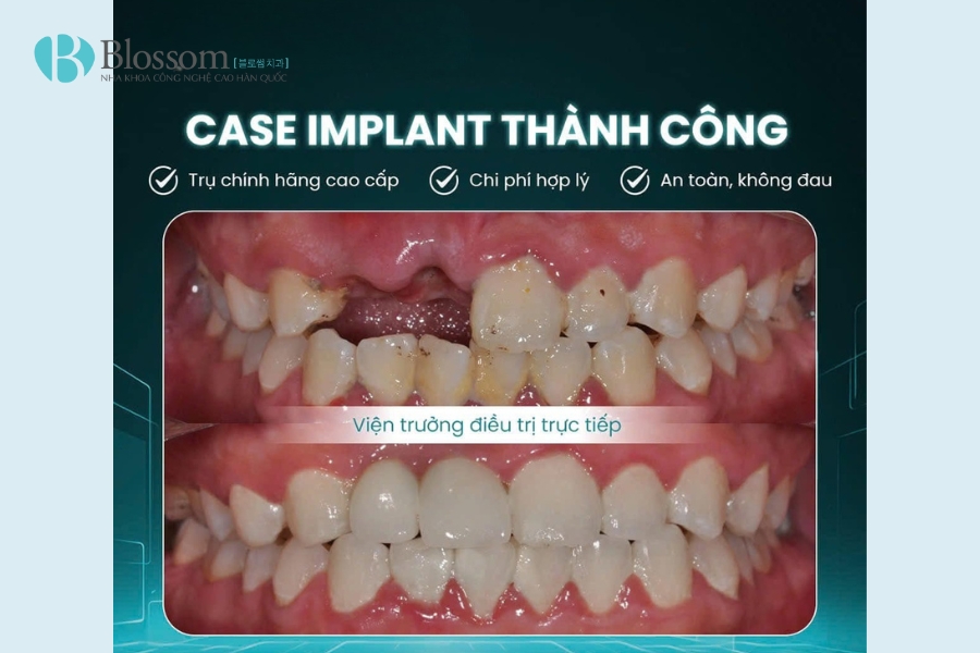 Tìm nha khoa quận 3 chất lượng? TOP 3 địa chỉ nha khoa bạn không nên bỏ qua 12 nha khoa quan 3 13