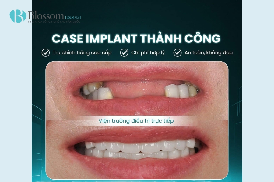 Tìm nha khoa quận 3 chất lượng? TOP 3 địa chỉ nha khoa bạn không nên bỏ qua 13 nha khoa quan 3 14