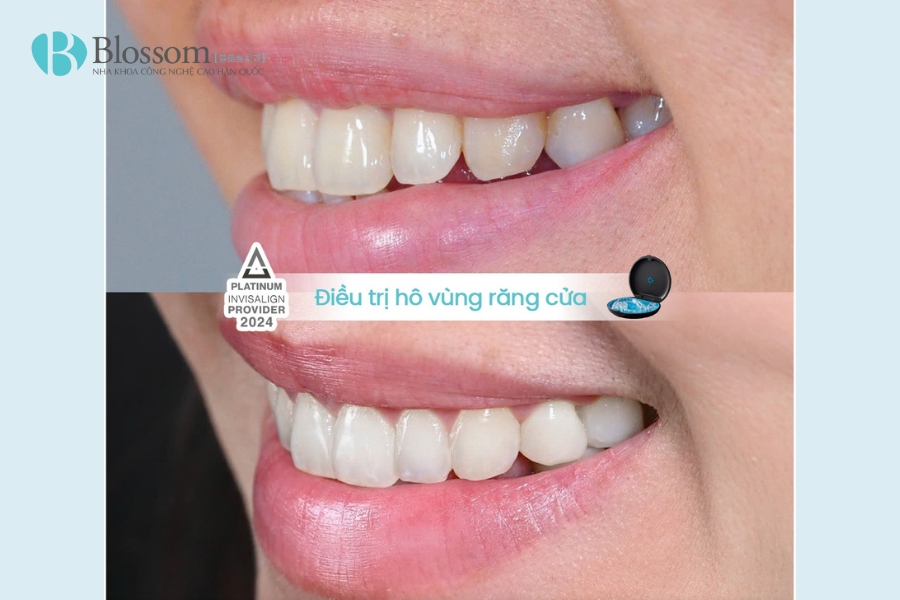 Tìm nha khoa quận 3 chất lượng? TOP 3 địa chỉ nha khoa bạn không nên bỏ qua 15 nha khoa quan 3 16