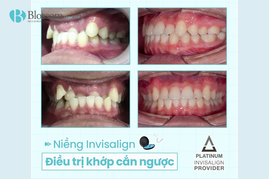 Tìm nha khoa quận 3 chất lượng? TOP 3 địa chỉ nha khoa bạn không nên bỏ qua 16 nha khoa quan 3 17