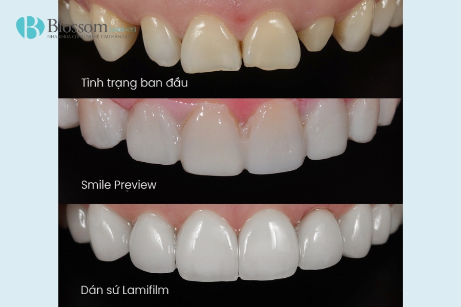 Tìm nha khoa quận 3 chất lượng? TOP 3 địa chỉ nha khoa bạn không nên bỏ qua 6 nha khoa quan 3 7