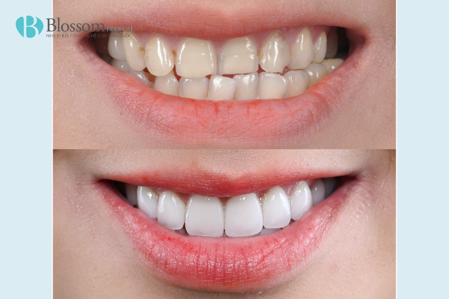 Tìm nha khoa quận 3 chất lượng? TOP 3 địa chỉ nha khoa bạn không nên bỏ qua 8 nha khoa quan 3 9
