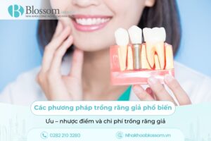 Các phương pháp trồng răng giả phổ biến hiện nay: Ưu – nhược điểm và chi phí trồng răng giả