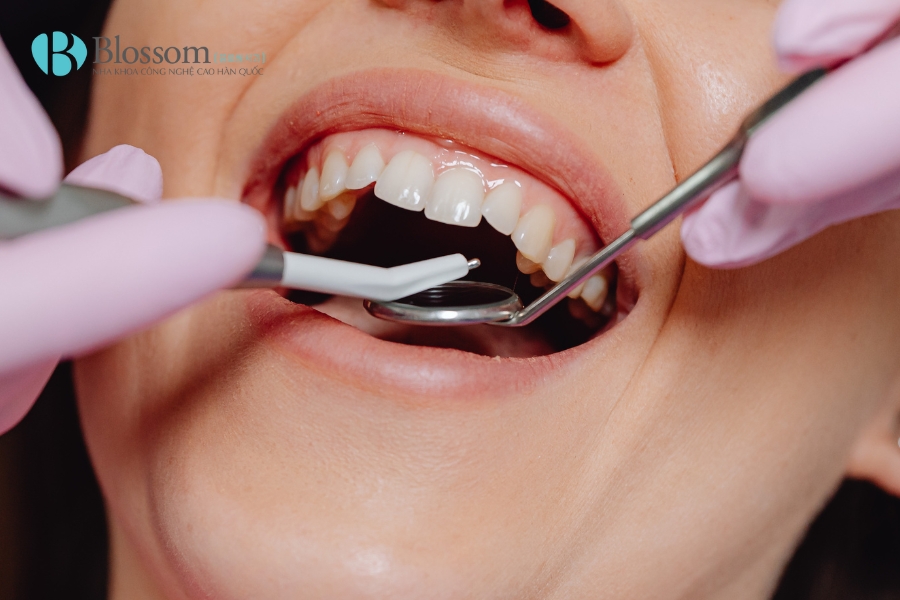 Các phương pháp trồng răng giả phổ biến hiện nay: Ưu – nhược điểm và chi phí trồng răng giả 10 phuong phap trong rang gia 10