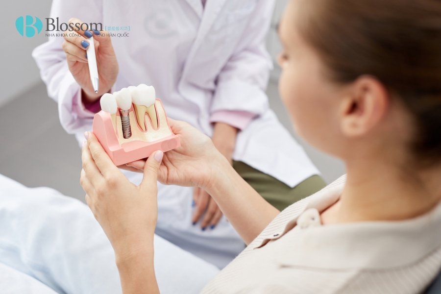 Các phương pháp trồng răng giả phổ biến hiện nay: Ưu – nhược điểm và chi phí trồng răng giả 9 phuong phap trong rang gia 9
