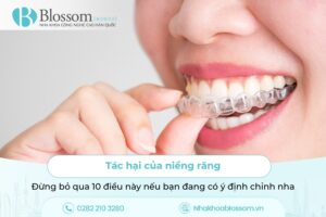 Mòn răng trầm trọng: Nguyên nhân, hậu quả và giải pháp phục hồi hiệu quả với dán sứ Lamifilm