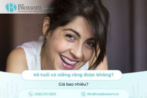 40 tuổi có niềng răng được không? Giá bao nhiêu?