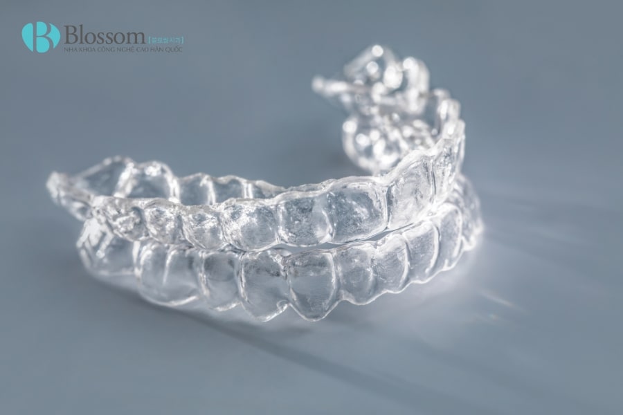 Địa chỉ niềng răng trẻ em tốt nhất: Tiêu chí lựa chọn và danh sách gợi ý mà phu huynh nên biết 4 dia chi nieng rang tre em 4 min 1