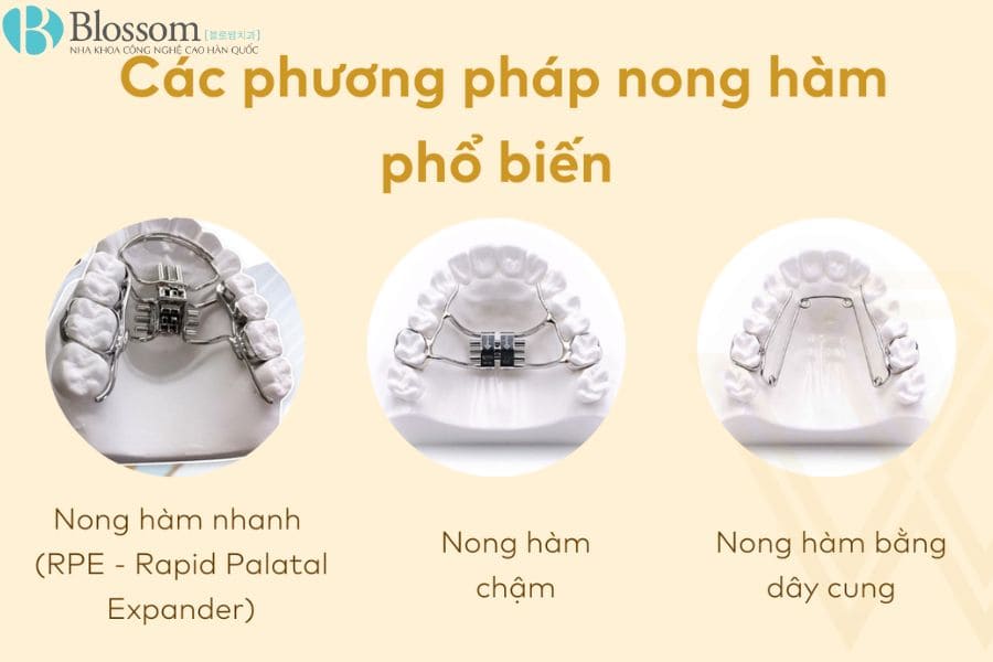 Nong hàm cho trẻ em: Lợi ích, phương pháp và những lưu ý quan trọng mà ba mẹ nên chú ý 3 nong ham cho tre em 3