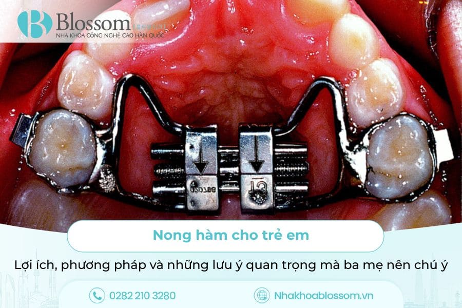 Nong hàm cho trẻ em: Lợi ích, phương pháp và những lưu ý quan trọng mà ba mẹ nên chú ý