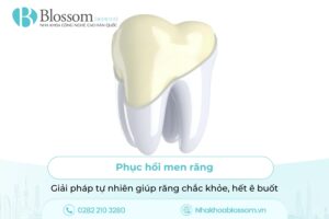 Phục hồi men răng – Giải pháp tự nhiên giúp răng chắc khỏe, hết ê buốt
