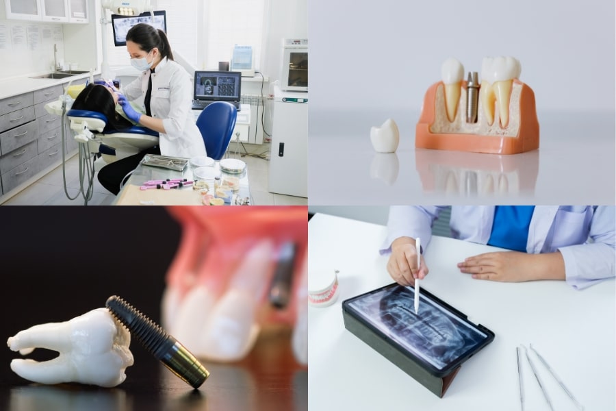 Những rủi ro khi trồng Implant giá rẻ? Cách lựa chọn nha khoa trồng Implant an toàn, tiết kiệm 4 implant gia re 4 min