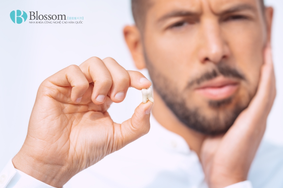 Răng khôn mọc lệch ra má có nguy hiểm không? Cách xử lý khi bị răng khôn mọc lệch ra má 4 rang khon moc lech ra ma 4