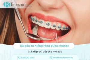 Bà bầu có niềng răng được không? Giải đáp chi tiết cho mẹ bầu