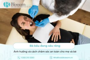 Bà bầu đang sâu răng: Ảnh hưởng và cách chăm sóc an toàn cho mẹ và bé