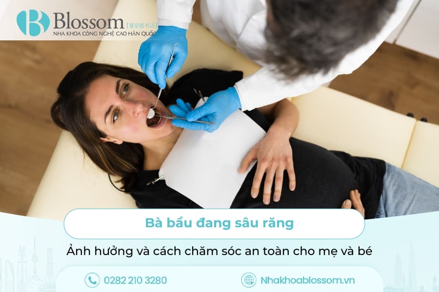 Bà bầu đang sâu răng: Ảnh hưởng và cách chăm sóc an toàn cho mẹ và bé