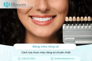 Bảng màu răng sứ và cách lựa chọn chuẩn nhất