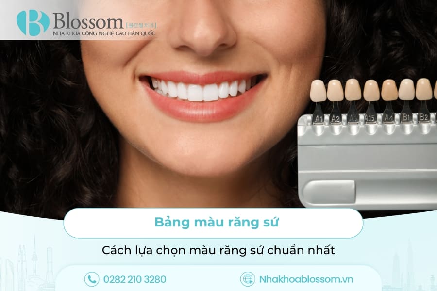 Bảng màu răng sứ và cách lựa chọn chuẩn nhất