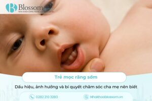 Trẻ mọc răng sớm: Dấu hiệu, ảnh hưởng và bí quyết chăm sóc cha mẹ nên biết