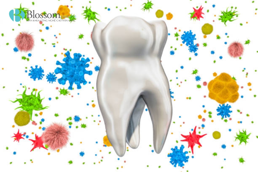 Vi khuẩn sâu răng là gì? Nguyên nhân, tác hại và cách phòng ngừa hiệu quả 1 vi khuan sau rang 1