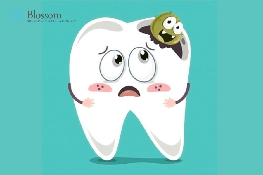 Vi khuẩn sâu răng là gì? Nguyên nhân, tác hại và cách phòng ngừa hiệu quả 7 vi khuan sau rang 7