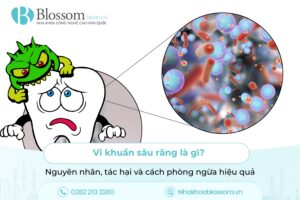 Vi khuẩn sâu răng là gì? Nguyên nhân, tác hại và cách phòng ngừa hiệu quả
