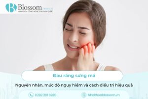 Đau răng sưng má: Nguyên nhân, mức độ nguy hiểm và cách điều trị hiệu quả