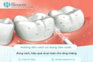 Hướng dẫn cách sử dụng tăm nước đúng cách, hiệu quả và an toàn cho răng miệng