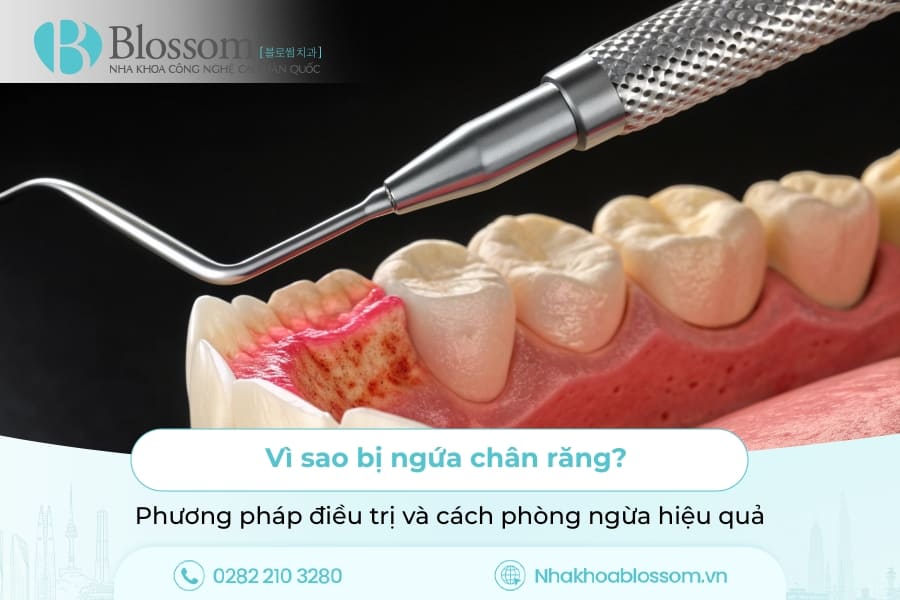 Vì sao bị ngứa chân răng? Phương pháp điều trị và cách phòng ngừa hiệu quả