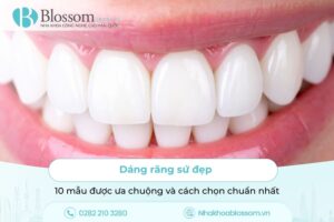 Dáng răng sứ đẹp – 10 mẫu được ưa chuộng và cách chọn chuẩn nhất