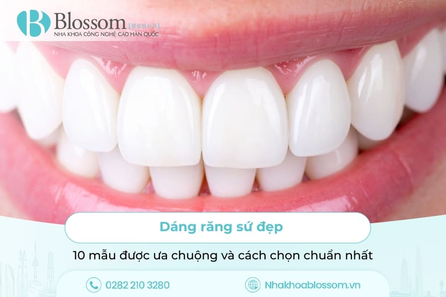Dáng răng sứ đẹp – 10 mẫu được ưa chuộng và cách chọn chuẩn nhất