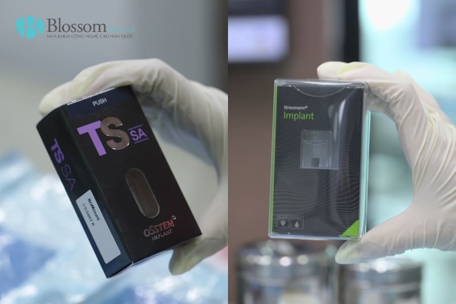 Top 12 địa chỉ trồng Implant uy tín tại TP.HCM 4 dia chi trong implant uy tin 12