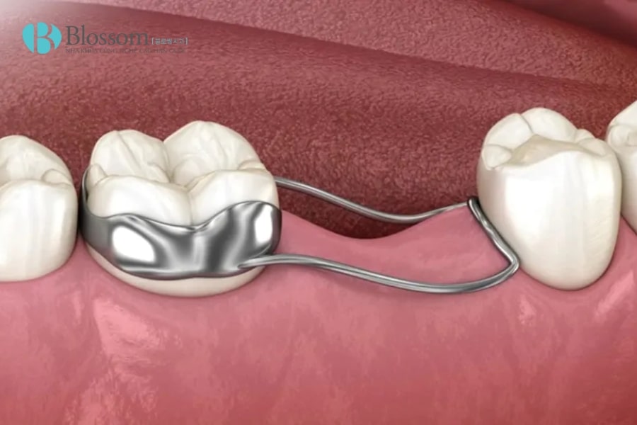 ham giu khoang 2 min