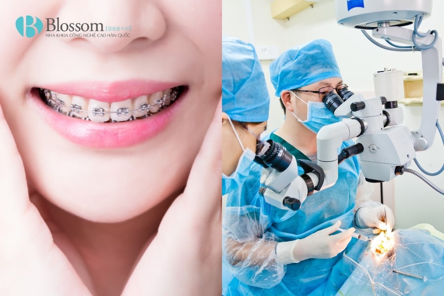 Phân biệt hô hàm và hô răng. Biết được cách điều trị hiệu quả, an toàn và triệt để 4 ho ham va ho rang 4 min