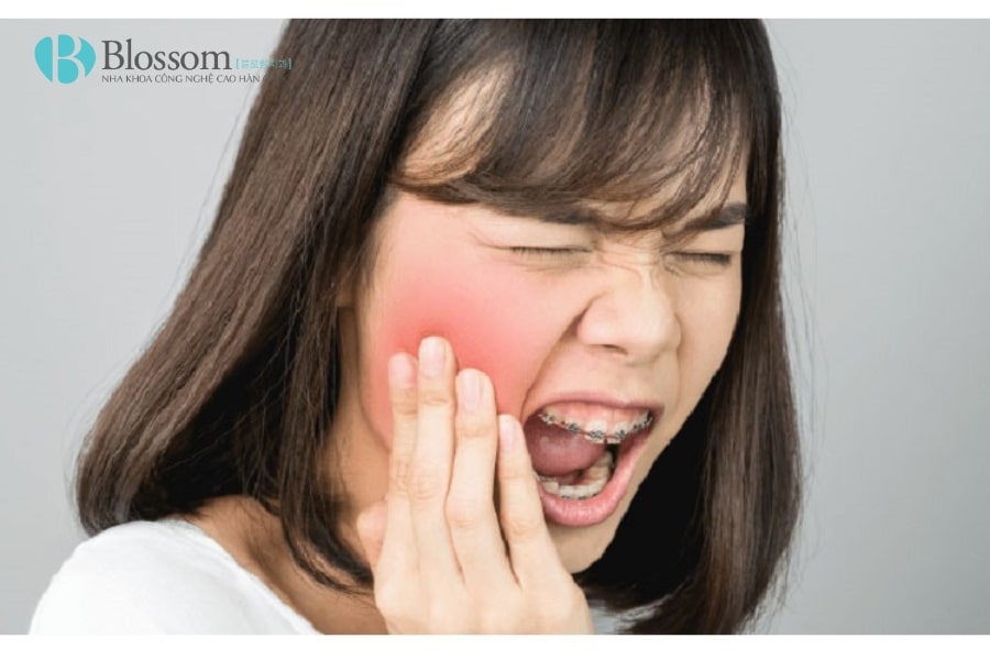 Bật mí mẹo trị nhức răng đơn giản giúp giảm đau tức thì tại nhà 4 tri nhuc rang 4 min