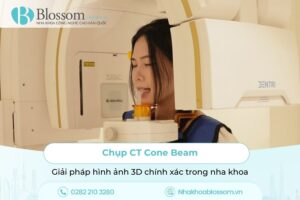 Chụp CT Cone Beam – Giải pháp hình ảnh 3D chính xác trong nha khoa