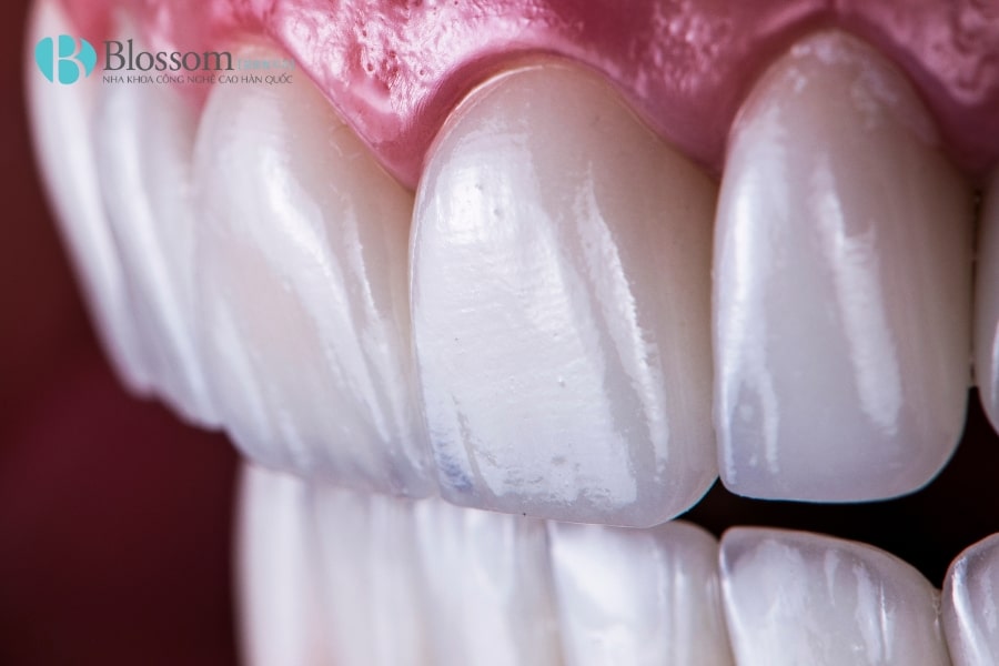 dan su khong mai co dau khong 1 min