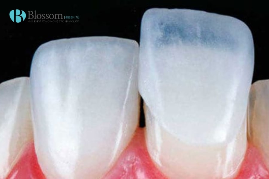 dan su khong mai co dau khong 4 min