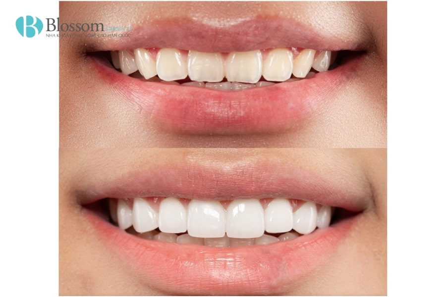 dan su khong mai co dau khong 6 min